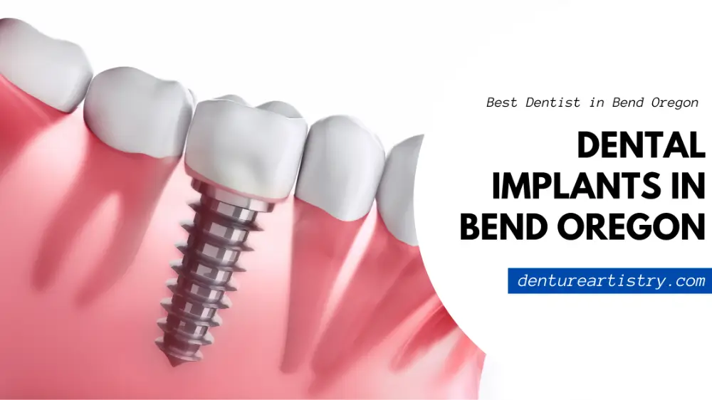 dental implants in bend oregon