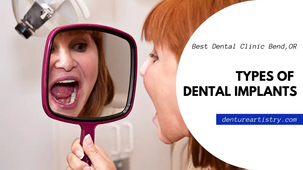 everything about dental implants, types of dental implants