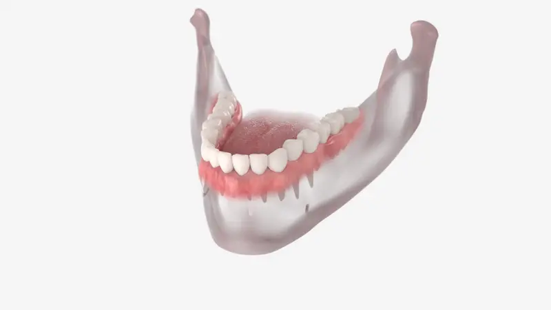 teeth extraction