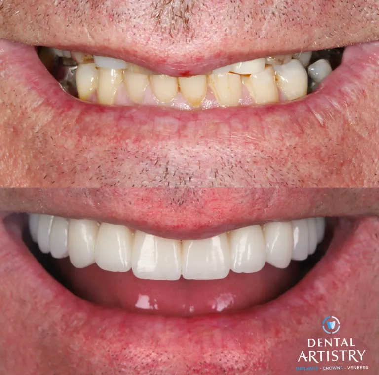 dental artistry