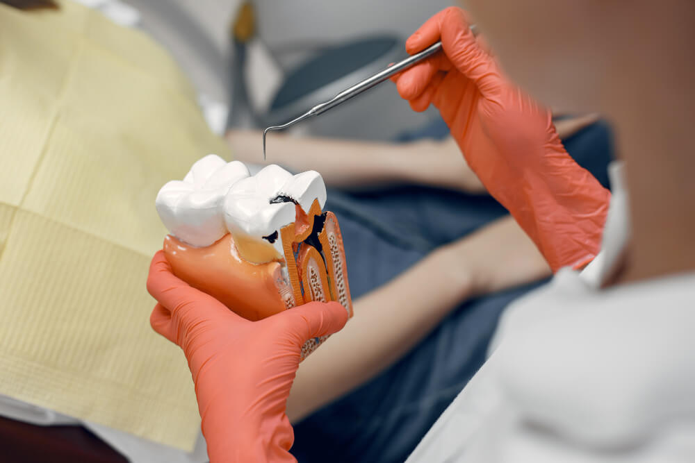 a dental professional holding a dental model with cavities