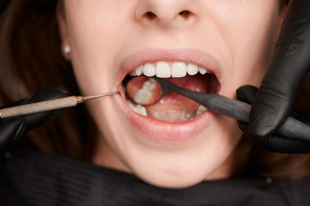 close-up shot of a person's teeth